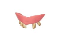 Gebit rotte tanden - thumbnail