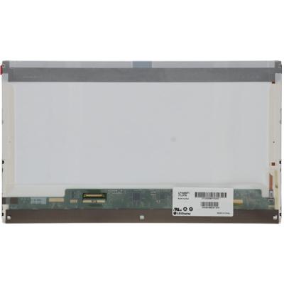 15.6 inch LCD Scherm 1920x1080 Glans 40Pin