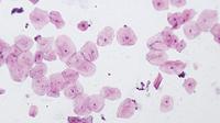 BRESSER Microscoop preparaten 10 stuks - thumbnail