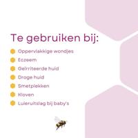 Dermel Huidzalf Tube 50g - thumbnail