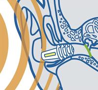 Sanohra Oordopjes Vliegtuig Kinderen - thumbnail