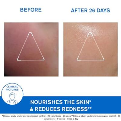 Uriage Xémose Face Cream - thumbnail