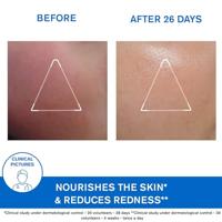 Uriage Xémose C 8+ Soin Visage Nourrissant Apaisant 40ml - thumbnail