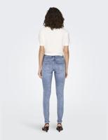Only Onlblush Mid Sk Ank Raw Dnm Rea694 Noos 15263454 Skinny Fit Medium Blue Denim - thumbnail