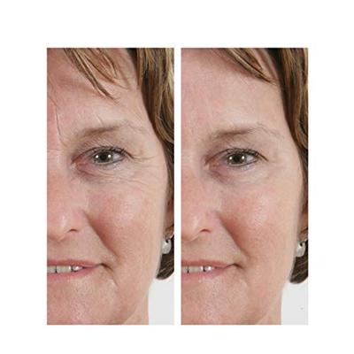 Orange Care Wrinkle Filler Serum Orange Care Wrinkle Filler Serum