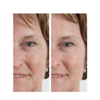 Orange Care Wrinkle Filler Serum - thumbnail