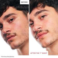 Erborian Skin Therpay 30ml - thumbnail