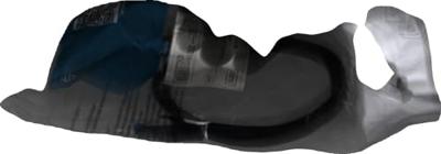 Digitus DK-1532-010/BL RJ45 Netwerkkabel, patchkabel CAT 5e SF/UTP 1.00 m Zwart Verdraaide paren 1 stuk(s) Digitus DK-1532-010/BL RJ45 Netwerkkabel, patchkabel CAT 5e SF/UTP 1.00 m Zwart Verdraaide paren 1 stuk(s)