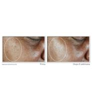RoC Multi Correxion Even Tone Lift Daily Moisturiser SPF30 50 ml Vochtinbrengende crème Dames - thumbnail