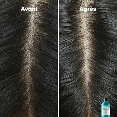 L'Oréal Professionnel Serie Expert Scalp Advanced Anti Dandruff Shampoo 1500ml