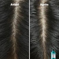 L'Oréal Professionnel Serie Expert Scalp Advanced Anti Dandruff Shampoo 1500ml - thumbnail