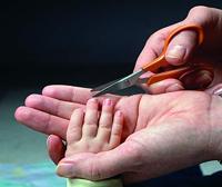 Fiskars 1003028 Nagelschaartje Linkshandig, Rechtshandig 100 mm Oranje - thumbnail