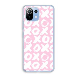 XOXO: Xiaomi Mi 11 Lite Transparant Hoesje