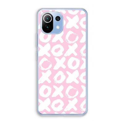 XOXO: Xiaomi Mi 11 Lite Transparant Hoesje