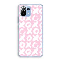 XOXO: Xiaomi Mi 11 Lite Transparant Hoesje