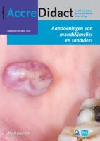Aandoeningen van mondslijmvlies en tandvlees (Paperback)