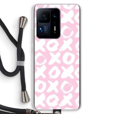XOXO: Xiaomi Mi Mix 4 Transparant Hoesje met koord