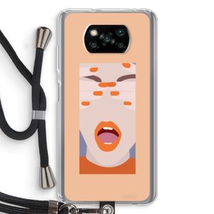 Surprise: Xiaomi Poco X3 NFC Transparant Hoesje met koord