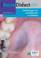 Aandoeningen van mondslijmvlies en tandvlees (Paperback)