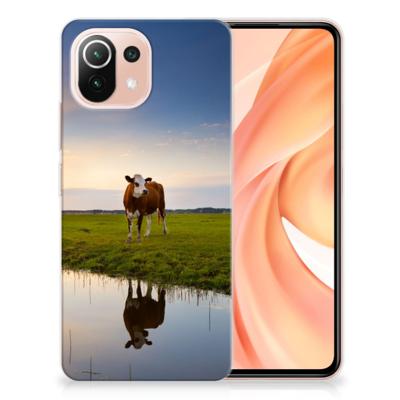 Xiaomi Mi 11 Lite | 11 Lite 5G NE | TPU Hoesje | Koe