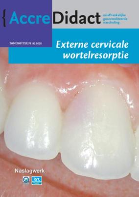 Externe cervicale wortelresorptie (Paperback)