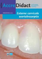Externe cervicale wortelresorptie (Paperback)