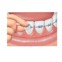 GUM Orthodontic Wax voor beugels - thumbnail