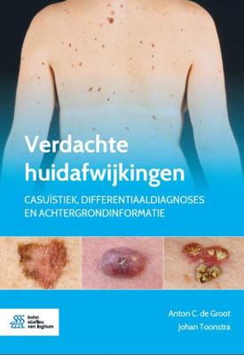 Verdachte huidafwijkingen (Paperback)