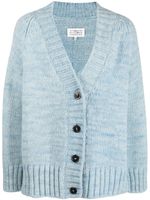 Maison Margiela cardigan à effet tie-dye - Bleu