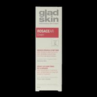 Gladskin Rosacea creme 30 Milliliter