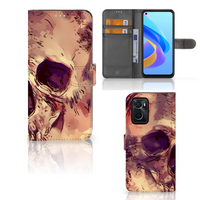 Telefoonhoesje met Naam OPPO A76 | A96 Skullhead - thumbnail