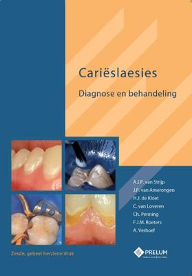 Carieslaesies (Hardback)