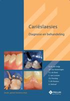 Carieslaesies (Hardback)
