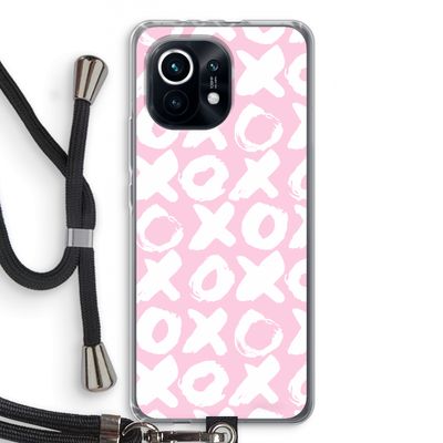 XOXO: Xiaomi Mi 11 Transparant Hoesje met koord