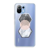 Creatieve toets: Xiaomi Mi 11 Lite Transparant Hoesje