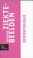 Zakboek ziektebeelden (Paperback)