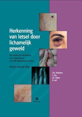 Herkenning van letsel door lichamelijk geweld (Paperback)