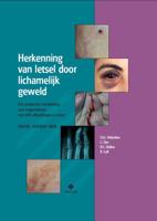 Herkenning van letsel door lichamelijk geweld (Paperback)