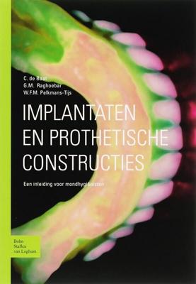 Implantaten en prothetische constructies (Paperback)