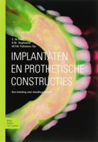 Implantaten en prothetische constructies (Paperback)