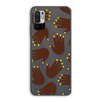 Hands dark: Xiaomi Redmi Note 10 5G Transparant Hoesje
