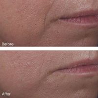 Perricone MD Cold Plasma Plus+ Advanced Serum Concentrate Gezichtsconcentraat 30 ml Vrouwen - thumbnail