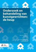 Kunstgewrichten: de heup (Paperback)