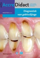 Diagnostiek van gebitsslijtage (Paperback)