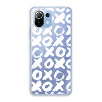 XOXO: Xiaomi Mi 11 Lite Transparant Hoesje