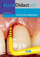 Nazorg bij implantaten (Paperback)