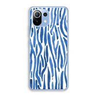 Blauwe nerven: Xiaomi Mi 11 Lite Transparant Hoesje Blauwe nerven: Xiaomi Mi 11 Lite Transparant Hoesje
