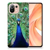 Xiaomi Mi 11 Lite | 11 Lite 5G NE | TPU Hoesje | Pauw