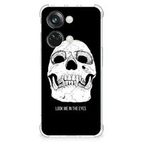 Extreme Case OnePlus Nord 3 Skull Eyes - thumbnail