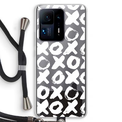 XOXO: Xiaomi Mi Mix 4 Transparant Hoesje met koord